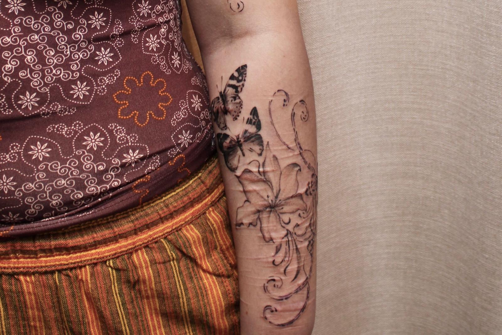 Tatovering på ar – Dæk dine ar med stil